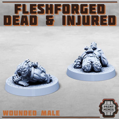 Fleshforged Dead + Injured Kit - Sci-Fi Grimdark City Skirmish Warfare Mercenaries